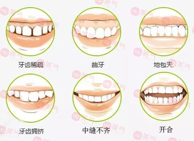 上海九院牙齒正畸哪個醫(yī)生比較好?楊一鳴、房兵醫(yī)生口碑介紹