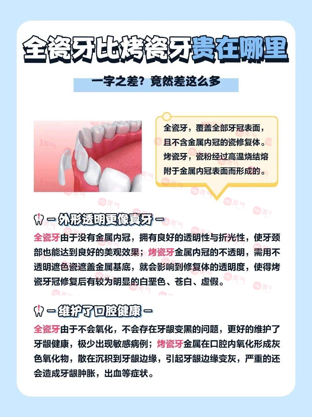 廣州全瓷牙價格多少？2023費用明細-全瓷牙優(yōu)勢、注意事項附上