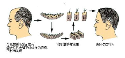 新疆整形美容醫(yī)院怎么樣?