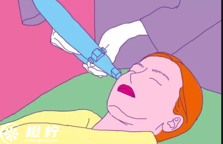 廣州激光祛斑醫(yī)院排名前五|哪里好？高人氣口碑機(jī)構(gòu)推薦