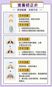 寬鼻梁矯正術(shù)真的有嗎?項(xiàng)目簡(jiǎn)介_真實(shí)案例_優(yōu)缺點(diǎn)介紹