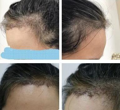 杭州格萊美醫(yī)療美容醫(yī)院怎么樣？