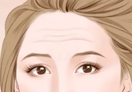 哈爾濱醫(yī)科大學附屬第二醫(yī)院拉皮除皺多少錢？附除皺案例以及介紹~