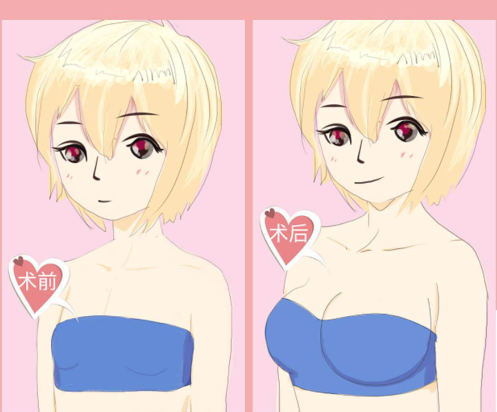 北醫(yī)三院美容整形科怎么樣？醫(yī)院信息＋案例分享