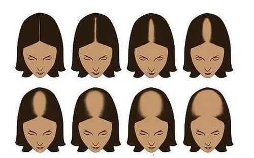 廣州市荔醫(yī)植發(fā)醫(yī)生介紹