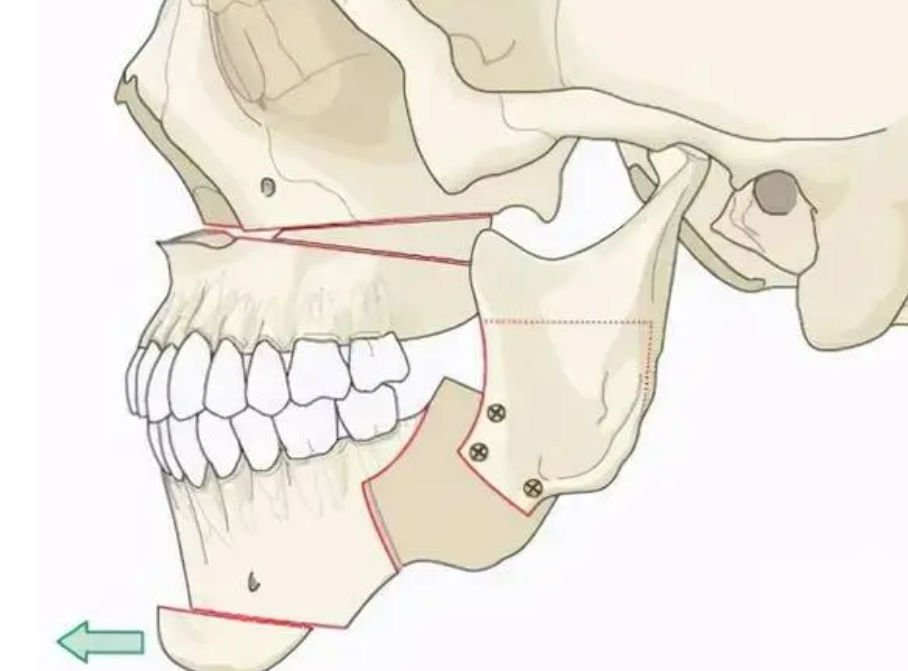 溫州藝星整形醫(yī)院怎么樣？科室概況、案例反饋