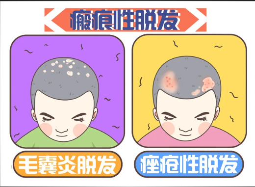 廣州倍生植發(fā)醫(yī)院技術(shù)如何？選對(duì)醫(yī)院不再為禿頭煩惱！