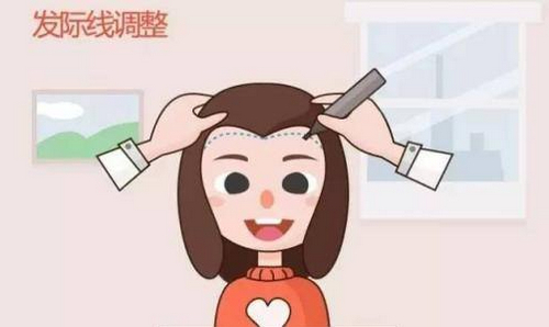 廣州青逸植發(fā)醫(yī)院靠譜嗎？醫(yī)生詳情及頭發(fā)種植案例