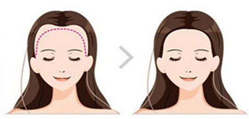 廣州市荔醫(yī)植發(fā)醫(yī)生介紹