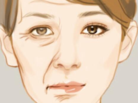 哈醫(yī)大二院除皺價格多少錢