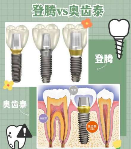 種植牙哪一種品牌最好？介紹10個比較有名的品牌