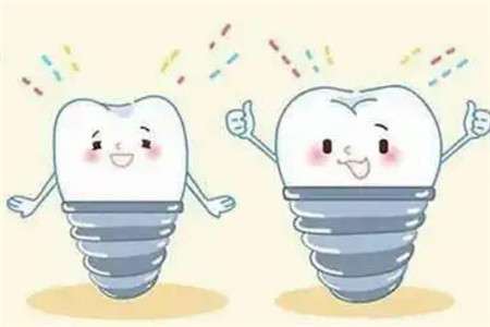 了解2024年種牙價(jià)格！一顆牙齒種植所需費(fèi)用大揭秘！