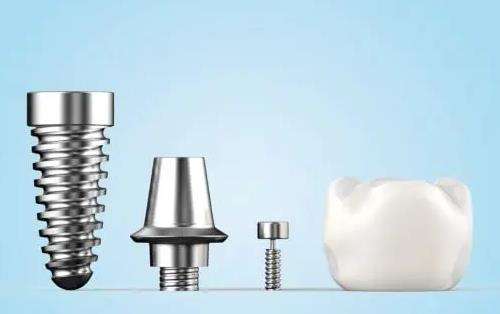 種植牙哪一種品牌最好？介紹10個比較有名的品牌