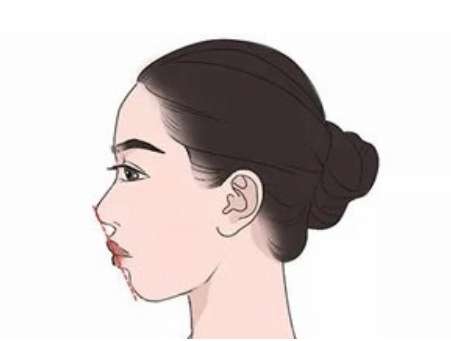 重慶王濤做的正頜怎么樣？在頜面外科擔任的主任醫(yī)生