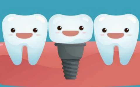 天津種植牙一顆一般多少？需要的費(fèi)用是3000元到2萬元之間