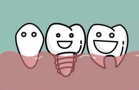 昆明種植牙怎么樣？有很多醫(yī)生可以熟練的操作