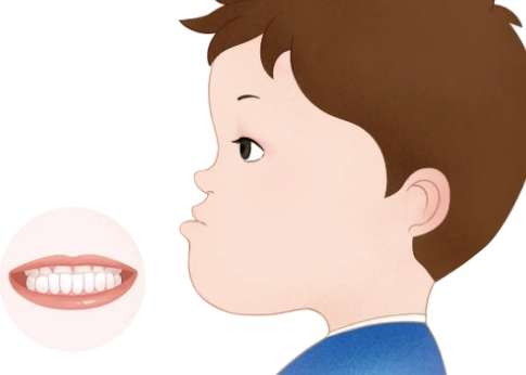 牙齒地包天怎么辦？可以采取的措施比較多，比如佩戴矯正器