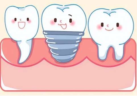 廈門種植牙多少錢一顆2024年？半口牙種植49396-141025元，單顆牙種植14332-25763元