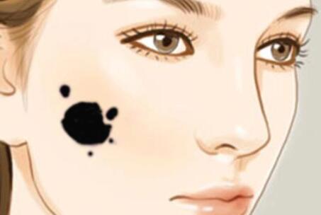 祛痣動漫09.jpg