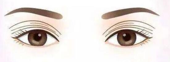 雙眼皮動(dòng)漫31.jpg