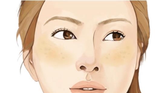 祛斑動漫h4.jpg