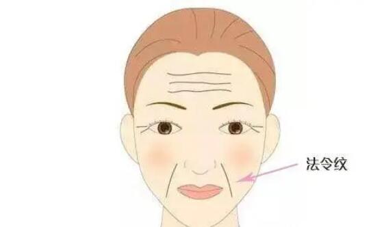 法令紋動(dòng)漫02.jpg