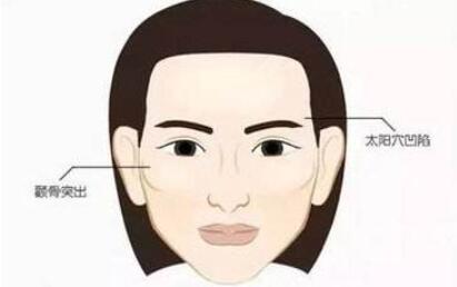 豐太陽(yáng)穴動(dòng)漫.jpg