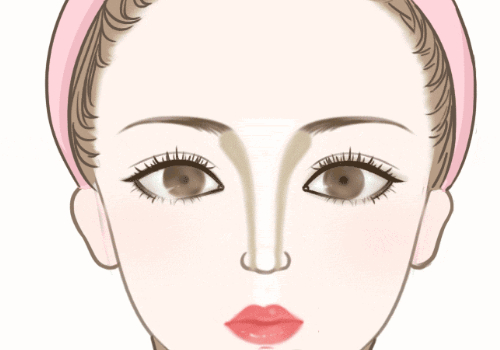 魏少魁做雙眼皮怎么樣?醫(yī)生簡介、雙眼皮案例分享