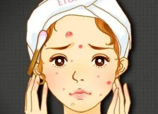 祛痘動漫h05.jpg
