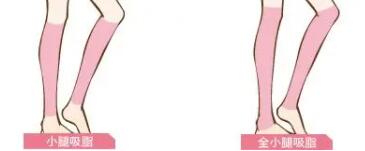 小腿吸脂動(dòng)漫07.jpg