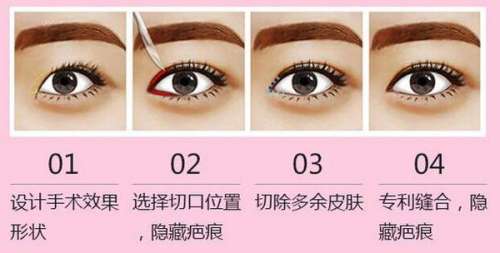 src=http _img.mp.itc.cn_upload_20170429_cdb3c37352524e71ac8829e014bb8121_th.jpg&refer=http _img.