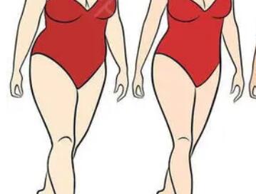 顧云鵬腰腹環(huán)吸價(jià)格大約是多少？醫(yī)生實(shí)力點(diǎn)評(píng)|真人案例展示！