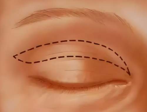 李方奇和王紹國誰的技術(shù)好？一鍵了解兩位醫(yī)生信息