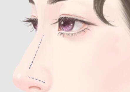 北京協(xié)和醫(yī)院龍飛隆鼻怎么樣？分享專家資料，含坐診醫(yī)院簡介