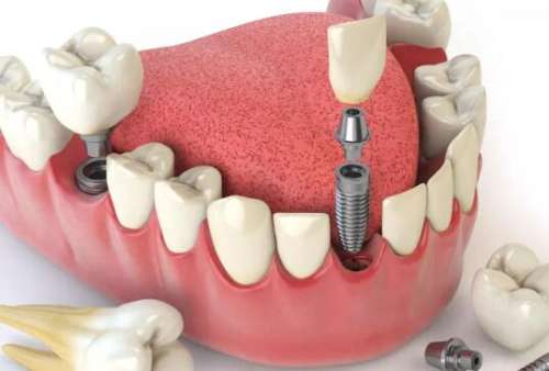 揚州貝恩口腔怎么樣？一鍵查詢醫(yī)院簡介和真實案例反饋