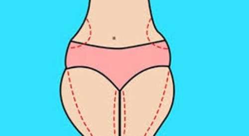 廣州美貝爾大腿吸脂的女人日記 分享！來看看前后差別大不大吧