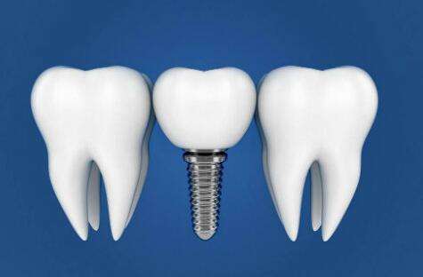 西南醫(yī)院種植牙技術(shù)好不好？匯集技術(shù)實(shí)力，含口腔科介紹