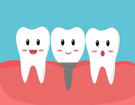 長沙中諾口腔種植牙價格表一覽？種植牙價格為5000元起