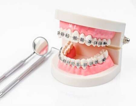 合肥第二人民醫(yī)院牙科價(jià)目表一覽？含2024年價(jià)格列表，附有掛號(hào)指南