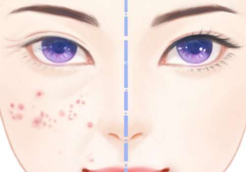 杭州三院光子嫩膚多少錢?醫(yī)院簡介及全新價(jià)格表更新