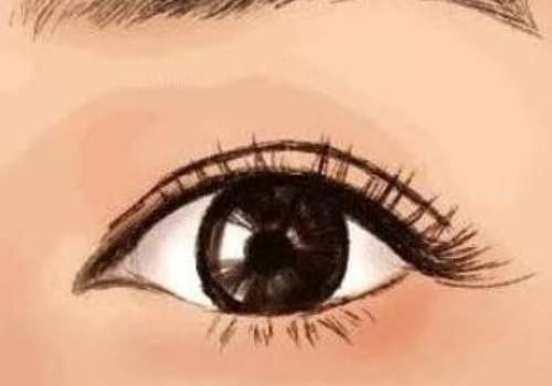 成都二醫(yī)院美容科割雙眼皮價(jià)格是多少?價(jià)格詳情及熱門項(xiàng)目一覽