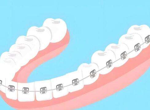寧波第一醫(yī)院牙齒矯正掛什么科？附科室信息、口碑如何？