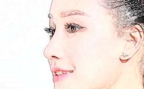 上海長征醫(yī)院肋骨鼻技術能力怎么樣?術后90天案例&醫(yī)院簡介