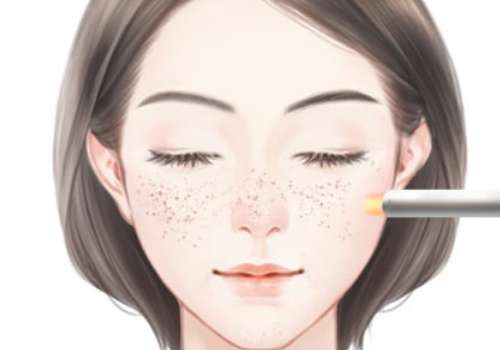 深圳市人民醫(yī)院激光祛斑價(jià)格需要多少?全新價(jià)格表及醫(yī)生名單公布