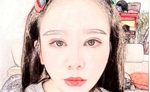 北京三甲玻尿酸填充醫(yī)院排名,給你不同選擇