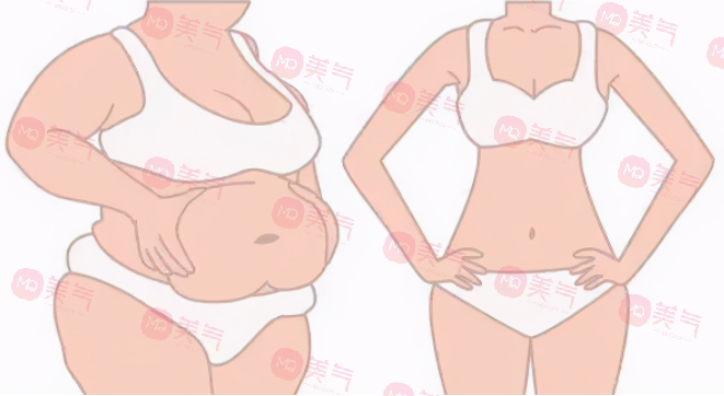 上海九院抽脂哪個醫(yī)生好？