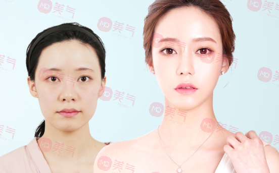 北京八大處整容醫(yī)院做輪廓整形多少錢？