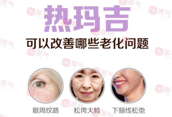 上海九院熱瑪吉怎么樣?