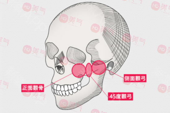 南醫(yī)大友誼磨骨費(fèi)用