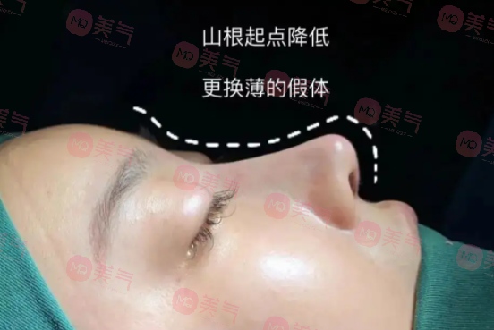 南京醫(yī)科大學(xué)友誼做鼻修復(fù)的費(fèi)用多少錢